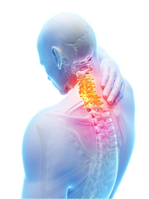 Vertebral Compression Fracture - Cahaba Pain and Spine Care